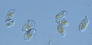 microscopic view of spores