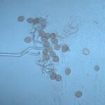 Figure 2: A highly magnified view of downy mildew spores on rose