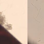 Figure 5 Caption: Microscopic images of Blumeriella jaapii spores: Lefthand side shows clumps of spores exuded from the cut leaf tissue; right hand shows individual spores, which are long and thin.