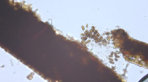 This is a leaf section of crabapple with frogeye leaf spot. The conidia shown here were observed after cutting a pycnidium of Diplodia seriata in half with a razor blade.Photo Credit: PPDL
